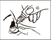 Mano sosteniendo un pequeño frasco con gotas, aplicando medicamento directamente en el ojo de una persona que sujeta suavemente el párpado inferior