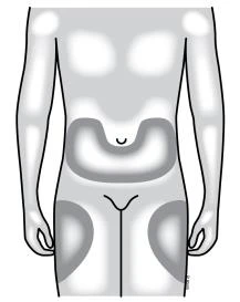 Schematic silhouette of a male torso with darker areas marked on the abdomen and both buttocks