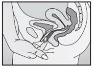Cross-sectional diagram of the female pelvis showing the uterus, bladder, and intestines, with a hand pointing to the vaginal area and entrance to the birth canal