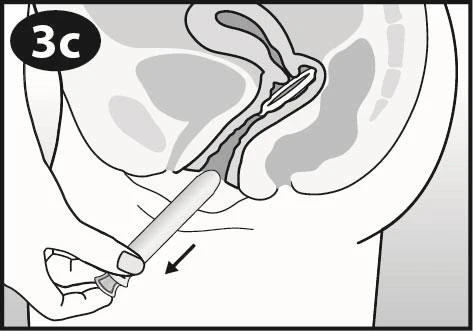 Cross-sectional diagram of the female pel vis showing a hand holding an applicator being inserted into the vagina for drug delivery