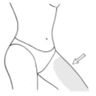 Disegno schematico del tronco e del bacino femminile con un'area grigia evidenziata sulla coscia, indicata da una freccia bianca
