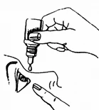 Hand holding a small bottle with a dropper, from which a drop of medication is falling directly into the eye of a person gently pulling down the lower eyelid