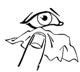 Drawing depicting a human eye and a finger pressing a tissue or cloth applied directly under the lower eyelid