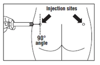Hand holding a syringe inserting the needle at a 90-degree angle into the buttock, indicating injection sites and marked points on the skin