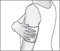 Illustration showing a hand holding and pressing a round adhesive patch or dressing onto the elbow crease and forearm of a figure