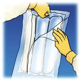 Manos con guantes amarillos sosteniendo y estirando una bolsa transparente con líquido médico sobre un fondo azul