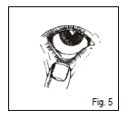 Primer plano del ojo humano con un dedo índice visible que toca el párpado inferior para aplicar gotas medicamentosas o realizar un examen