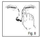Dibujo que muestra el rostro de una persona señalando con el dedo índice el ángulo interno del ojo, lo que sugiere el lugar de aplicación del medicamento o un síntoma