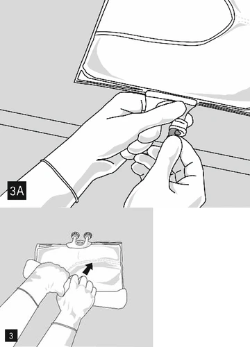 Hands unscrewing the cap from a flexible pouch and hands firmly squeezing the bag to expel contents into the device
