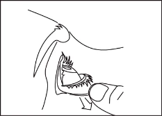 Disegno schematico che mostra una mano che impugna e applica un dispositivo medico sulla pelle nella zona dell'anca o dell'addome