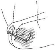 A hand holding a syringe and inserting the needle at an angle into the fatty tissue of the abdomen, marked with dashed lines and hatching