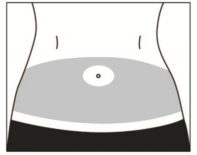 Schematic silhouette of the torso with a gray area marked on the abdomen and a white circle with a black dot in the center indicating the navel