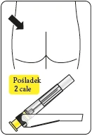 Schematic illustration showing injection site in the buttock and a syringe positioned at an angle relative to the body