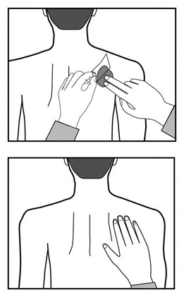 Schema di applicazione di un cerotto sulla schiena di una persona, che mostra prima il cerotto trattenuto con le mani, seguito poi da una mano che liscia la superficie del cerotto sulla pelle