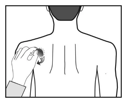 Mano con applicatore che esegue un movimento circolare sulla schiena di un uomo, simboleggiante l'applicazione del farmaco lungo tre linee verticali sulla pelle