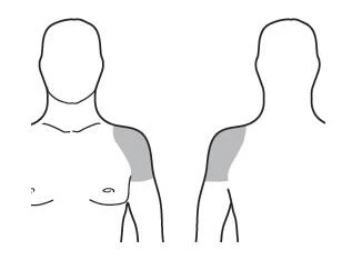 Contornos esquemáticos de una silueta masculina de frente y de perfil, con una zona gris marcada en la parte superior del brazo y en el músculo deltoides