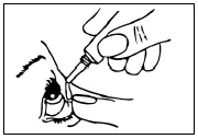 A hand holding a small bottle with an applicator, dispensing medication drops directly into the eye of a person looking upward
