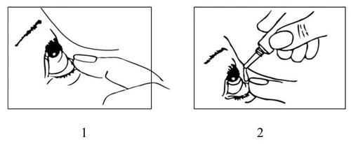 La figura 1 muestra un dedo que tira del párpado inferior del ojo, y la figura 2 muestra una mano sosteniendo un gotero aplicando una gota del medicamento en el ojo