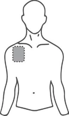 Silueta masculina con un parche rectangular gris ubicado en el hombro derecho y la parte superior del tórax