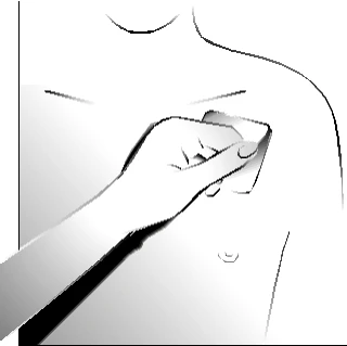 Mano aplicando un pequeño parche cuadrado sobre el tórax de un hombre para administrar el medicamento o proteger una zona de la piel