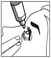 Disegno che mostra un applicatore che versa una goccia di farmaco direttamente nell'occhio di una persona, mentre un dito tira delicatamente verso il basso la palpebra inferiore