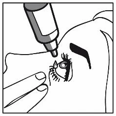 Dibujo que muestra un acercamiento del rostro de una persona, con el ojo abierto y una gota de medicamento saliendo del párpado superior, administrada mediante un dispensador