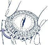 Hands holding a round, notched cap being twisted counterclockwise using the blue arrow to open the medication package