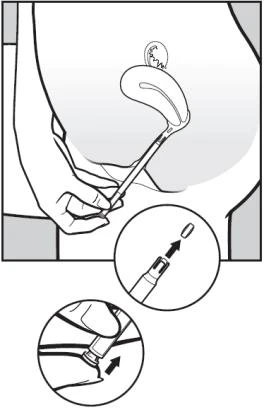 Mano che impugna un applicatore, con primo piano sull'inserimento della capsula nel dispositivo e sull'azione di premere lo stantuffo per somministrare il farmaco