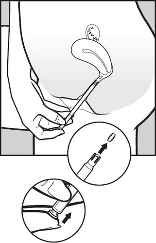 Illustrazione che mostra il processo di somministrazione di un farmaco per iniezione nell'addome e primi piani che mostrano l'inserimento di una capsula nel dispositivo e la pressione dello stantuffo