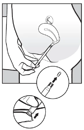 Mano che impugna un'iniezione premendo l'estremità sull'addome, con un ingrandimento che mostra la rimozione del cappuccio e il metodo di somministrazione del farmaco