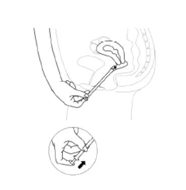Illustrazione schematica che mostra una mano che impugna un applicatore inserito nella vagina e un primo piano sul modo di afferrare il dispositivo indicato con una freccia