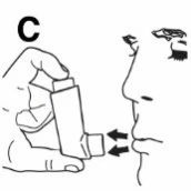 Illustration showing a hand holding an inhaler at a person's mouth, with arrows indicating the direction of medication delivery into the oral and nasal cavity
