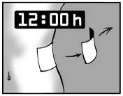 Schematic drawing showing a clock indicating 12:00 and the process of removing a patch from the skin surface using arrows to indicate direction