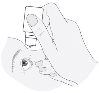 A hand holding a small bottle above an open eye of a person, pulling down the lower eyelid with a finger to administer eye drops