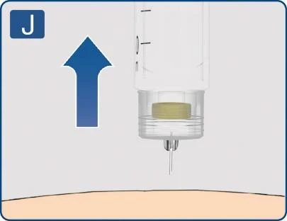 Blue arrow pointing upward indicating direction of syringe with needle above the skin surface