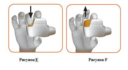 Hand holding an inhaler; in Figure E, an arrow indicates pressing the button; in Figure F, lifting the button after use