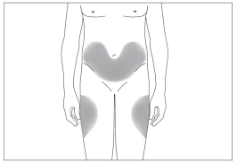 Schematic illustration of the human body with highlighted areas for injection