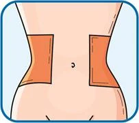 Two orange rectangles on the sides of the torso indicating application sites of a medical product, with the navel centered