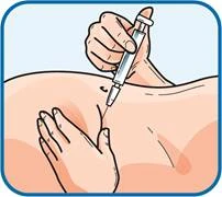 One hand holding a syringe at a 45-degree angle inserting the needle into abdominal muscle tissue, the other hand stretching the skin taut