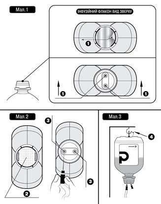 Infusion bottle with connection diagram: top view with arrows, connected to a syringe and hanging with labels 1–4 for correct usage