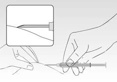 A hand holding a syringe inserting the needle at an angle into the skin, with an enlarged view showing precise needle placement within the tissue