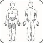 Schema del corpo umano con aree indicate per iniezioni