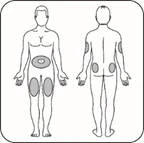 Schema del corpo umano con aree indicate per iniezioni