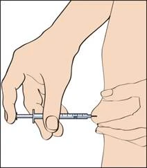 Hand holding a syringe at a 45-degree angle, inserting needle into muscle tissue of the arm, the other hand holding skin around the injection site