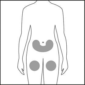 Representación esquemática del cuerpo humano con zonas marcadas para in