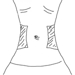 Schematic illustration of the human torso with marked shaded areas on the sides of the abdomen for injection