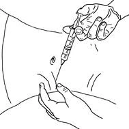 Hand holding a syringe at a 45-degree angle, inserting the needle into the muscle tissue of the arm, the other hand keeping the skin taut for injection
