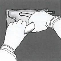 Gloved hands holding a syringe, inserting the needle at an angle into the skin, with an arrow showing the direction of solution administration