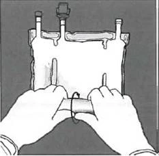 Two hands holding a transparent bag containing liquid, attached to two tubes with clamps, indicating preparation for infusion or fluid transfusion