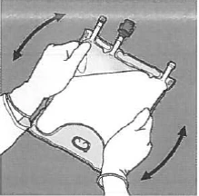 Hands holding a medical device with two handles moving clockwise and counterclockwise for performing a procedure